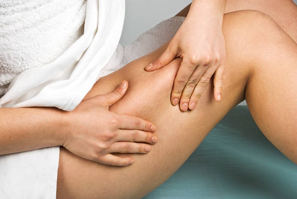 Body contouring with VelaShape