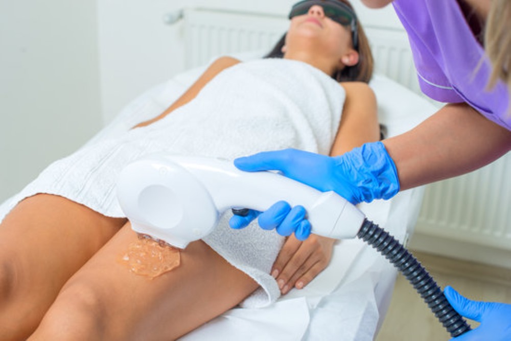 Body contouring with VelaShape